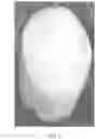 Fig. 02 - NANOCOMPOSITE FIBERS WITH A DRAMATIC REDUCTION IN HUMAN PLASMA COAGULATION TIME