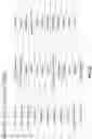 Fig. 45 - METHOD AND APPARATUS FOR TREATING BONE FRACTURES, AND/OR FOR FORTIFYING AND/OR AUGMENTING BONE, INCLUDING THE PROVISION AND USE OF COMPOSITE IMPLANTS, AND NOVEL COMPOSITE STRUCTURES WHICH MAY BE USED FOR MEDICAL AND NON-MEDICAL APPLICATIONS