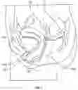 Fig. 02 - Methods, compositions and kits for surgical repair