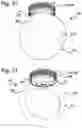 Fig. 15 - MEDICAL INFUSION PUMP HOLDER