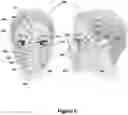 Fig. 07 - ENHANCED SYSTEM AND METHOD FOR USING A PRESSURIZED HYALURONIC ACID INJECTION DEVICE FOR AESTHETIC ENHANCEMENT OF SKIN APPEARANCE
