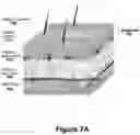 Fig. 08 - ENHANCED SYSTEM AND METHOD FOR USING A PRESSURIZED HYALURONIC ACID INJECTION DEVICE FOR AESTHETIC ENHANCEMENT OF SKIN APPEARANCE