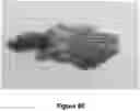 Fig. 14 - ENHANCED SYSTEM AND METHOD FOR USING A PRESSURIZED HYALURONIC ACID INJECTION DEVICE FOR AESTHETIC ENHANCEMENT OF SKIN APPEARANCE
