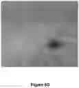 Fig. 16 - ENHANCED SYSTEM AND METHOD FOR USING A PRESSURIZED HYALURONIC ACID INJECTION DEVICE FOR AESTHETIC ENHANCEMENT OF SKIN APPEARANCE