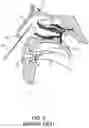 Fig. 03 - APPARATUS, SYSTEM, AND METHOD FOR FACILITATING INTRANASAL TREATMENT OF A PATIENT