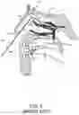 Fig. 04 - APPARATUS, SYSTEM, AND METHOD FOR FACILITATING INTRANASAL TREATMENT OF A PATIENT