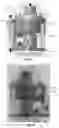 Fig. 10 - RESPIRATORY VENTILATION DEVICE