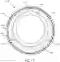 Fig. 11 - Catheter with heat transfer minimizing annular space