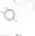 Fig. 14 - Catheter with heat transfer minimizing annular space