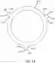 Fig. 19 - Catheter with heat transfer minimizing annular space