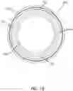 Fig. 20 - Catheter with heat transfer minimizing annular space