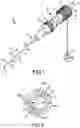 Fig. 02 - INTRODUCER WITH STEERABLE DISTAL TIP SECTION