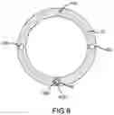 Fig. 11 - INTRODUCER WITH STEERABLE DISTAL TIP SECTION