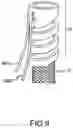 Fig. 12 - INTRODUCER WITH STEERABLE DISTAL TIP SECTION
