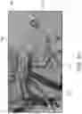 Fig. 07 - ASPIRATION CATHETER SYSTEMS AND METHODS OF USE