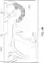 Fig. 09 - ASPIRATION CATHETER SYSTEMS AND METHODS OF USE