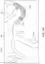 Fig. 10 - ASPIRATION CATHETER SYSTEMS AND METHODS OF USE