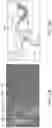 Fig. 13 - ASPIRATION CATHETER SYSTEMS AND METHODS OF USE