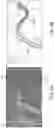 Fig. 15 - ASPIRATION CATHETER SYSTEMS AND METHODS OF USE