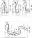 Fig. 23 - ASPIRATION CATHETER SYSTEMS AND METHODS OF USE