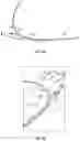 Fig. 05 - RADIAL ARTERY ADAPTOR