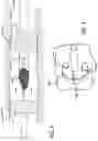 Fig. 05 - Pulmonary Embolism Removal System
