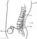 Fig. 01 - Optimized intrathecal drug delivery