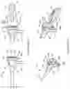Fig. 06 - HEMOSTATIC VALVE EXTENSION
