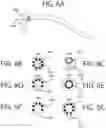 Fig. 08 - LEAD TEMPLATE AND METHOD OF USE AT A SPINAL TREATMENT SITE