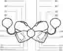 Fig. 01 - Cochlear Implant Retention and Concealment Bow