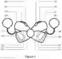 Fig. 02 - Cochlear Implant Retention and Concealment Bow