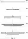 Fig. 10 - Sensing cardiac signals with leads implanted in epidural space
