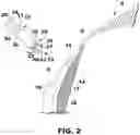 Fig. 03 - VfA cardiac resynchronization therapy