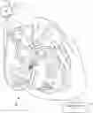 Fig. 01 - Capture in ventricle-from-atrium cardiac therapy