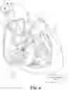 Fig. 05 - Capture in ventricle-from-atrium cardiac therapy