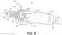 Fig. 10 - Capture in ventricle-from-atrium cardiac therapy
