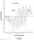 Fig. 03 - Magnetic Stimulation With Random Variable Pulsed Intervals