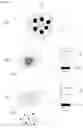 Fig. 03 - METHOD FOR EXTRACTING MICROVESICLES FROM BIOLOGICAL SAMPLE