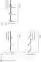 Fig. 04 - Filtration apparatus and operation method therefor