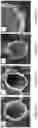 Fig. 24 - COLLOIDOSOMES AND POROUS MATERIALS BY PICKERING EMULSIONS
