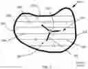 Fig. 11 - Systems and methods for low level waste disposal