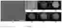 Fig. 05 - Laser scanning ablation synthesis of medium-entropy and high-entropy particles with size from nanometer to micrometer