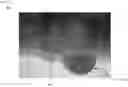 Fig. 06 - USING X-RAY ANALYSIS DURING REFLOW THERMAL CYCLE FOR SOLDER JOINTS
