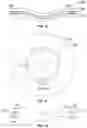 Fig. 08 - Embedded electronic circuit in grinding wheels and methods of embedding