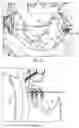 Fig. 10 - AUTOMATIC WASHOUT SYSTEM FOR A MIXER VEHICLE