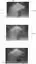 Fig. 05 - Method of producing a test body for diffusion tensor imaging