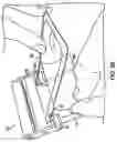 Fig. 11 - PROTECTIVE MATERIAL APPLICATOR DEVICE