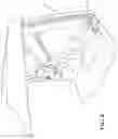 Fig. 09 - Hard support corner for a soft top