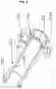 Fig. 10 - Drive train comprising two separate shiftable gear mechanisms which are coupled by means of intermediate gear mechanisms
