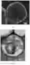 Fig. 05 - Hollow carbon sphere with multi-stage pore structure and preparation method therefor